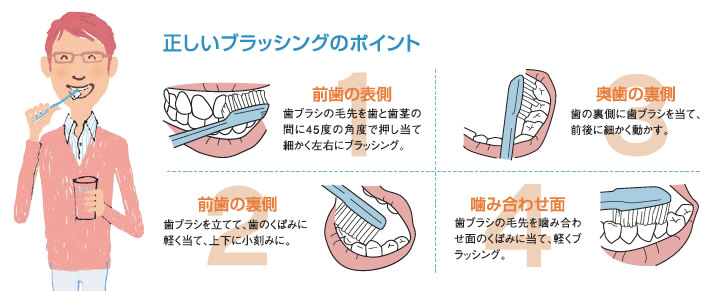 正しいブラッシングのポイント (1)前歯の表側…歯ブラシの毛先を歯と歯茎の間に45度の角度で押し当て細かく左右にブラッシング。 (2)前歯の裏側…歯ブラシを立てて、歯のくぼみに軽く当て、上下に小刻みに。 (3)奥歯の裏側…歯の裏側に歯ブラシを当て、前後に細かく動かす。 (4)噛み合わせ面…歯ブラシの毛先を噛み合わせ面のくぼみに当て、軽くブラッシング。